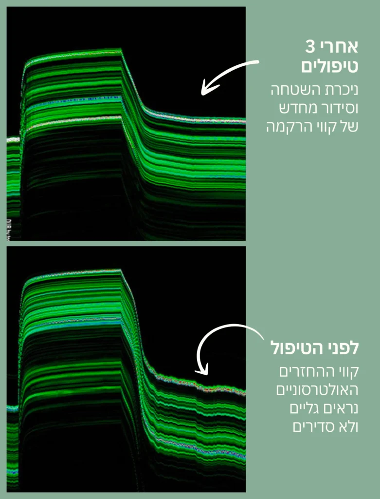 מיגור דלקת ושיקום מחסום העור